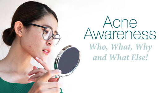 Acne Awareness, Who, What, Why and What Else!