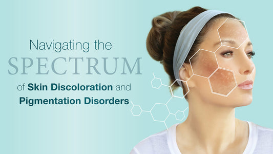 Navigating the Spectrum of Skin Discoloration and Pigmentation Disorders