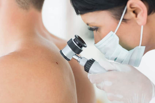 How to Detect Skin Cancer Early