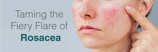 Taming the Fiery Flare of Rosacea