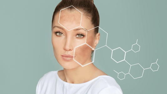 Hyperpigmentation and Melasma: What are they? How are they similar, how are they different? Most importantly, how do you address them with clinical skincare?