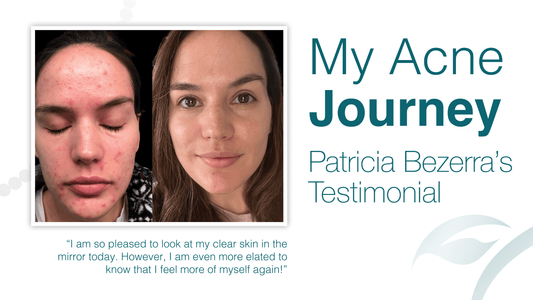 My Acne Journey - Patricia Bezerra's Testimony